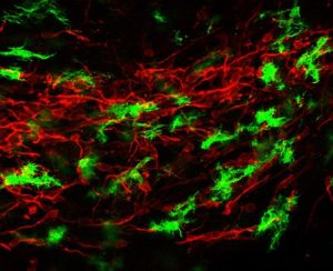 Immunfluoreszenzbild vom Gehirn junger Mäuse mit Crebraler Malaria: Mit den aktivierten Immunzellen des Gehirns (Mikrogliazellen, grün) breitet sich die Entzündung entlang eines röhrenförmigen Areals, des rostralen Migrationsstrangs (rot), bis in tiefere Hirnstrukturen aus. Dieser „Korridor“ für unreife Nerven- sowie Immunzellen im sich entwickelnden Gehirn junger Säugetiere ist offensichtlich besonders durchlässig und begünstigt die überschießende Entzündungsreaktion. Foto: Universitätsklinikum Heidelberg